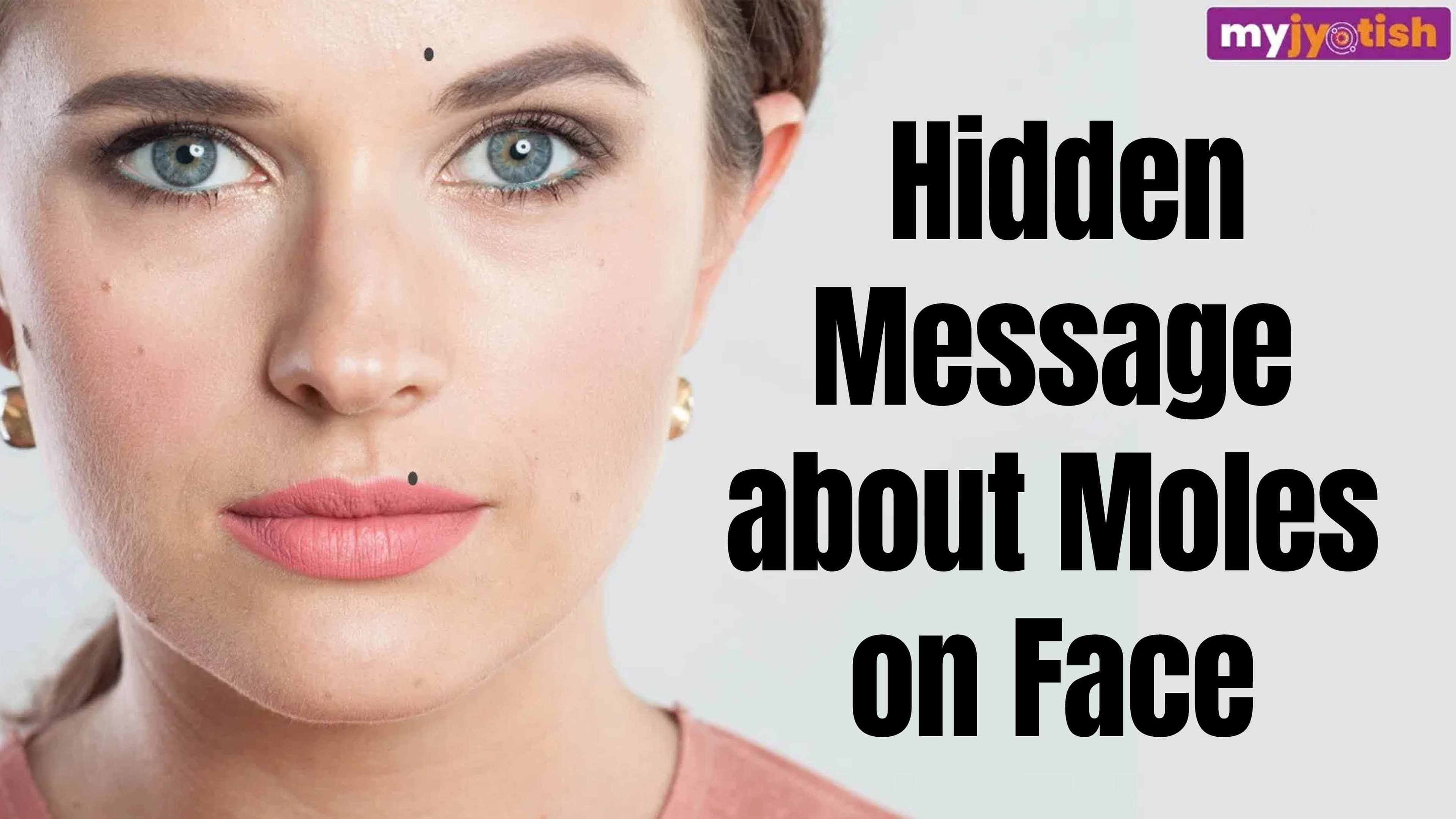 Moles on Face: Having Moles On These Parts Of Body Makes A Person Lucky | Check Here